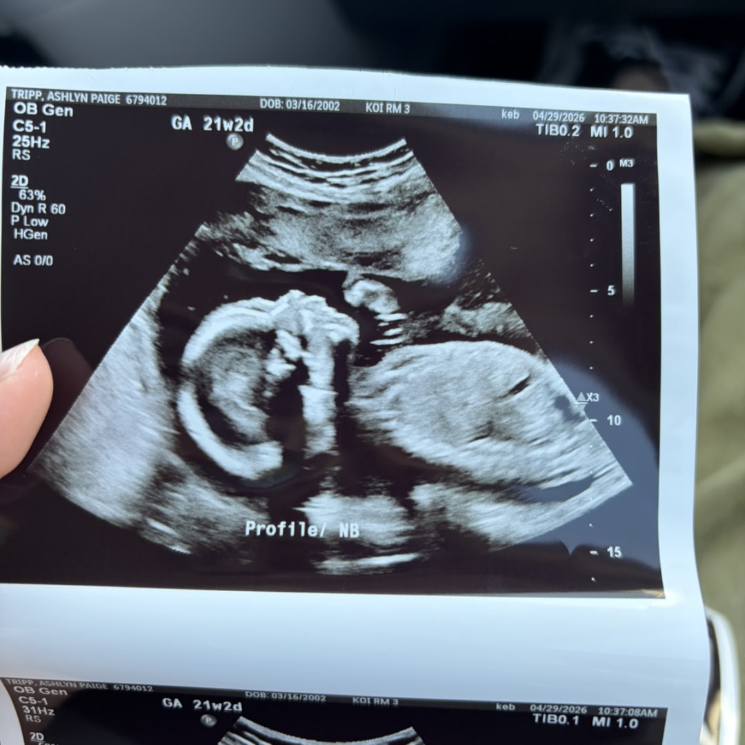 Photo shared by Ashlyn for their Babylist baby registry.