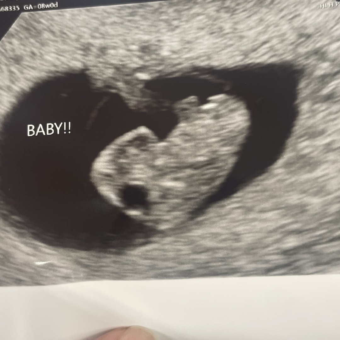 Photo shared by Calaybra for their Babylist baby registry.