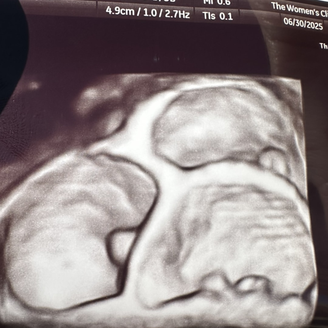 Photo shared by Jordan for their Babylist baby registry.