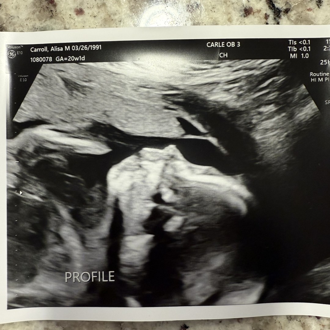 Photo shared by Alisa for their Babylist baby registry.