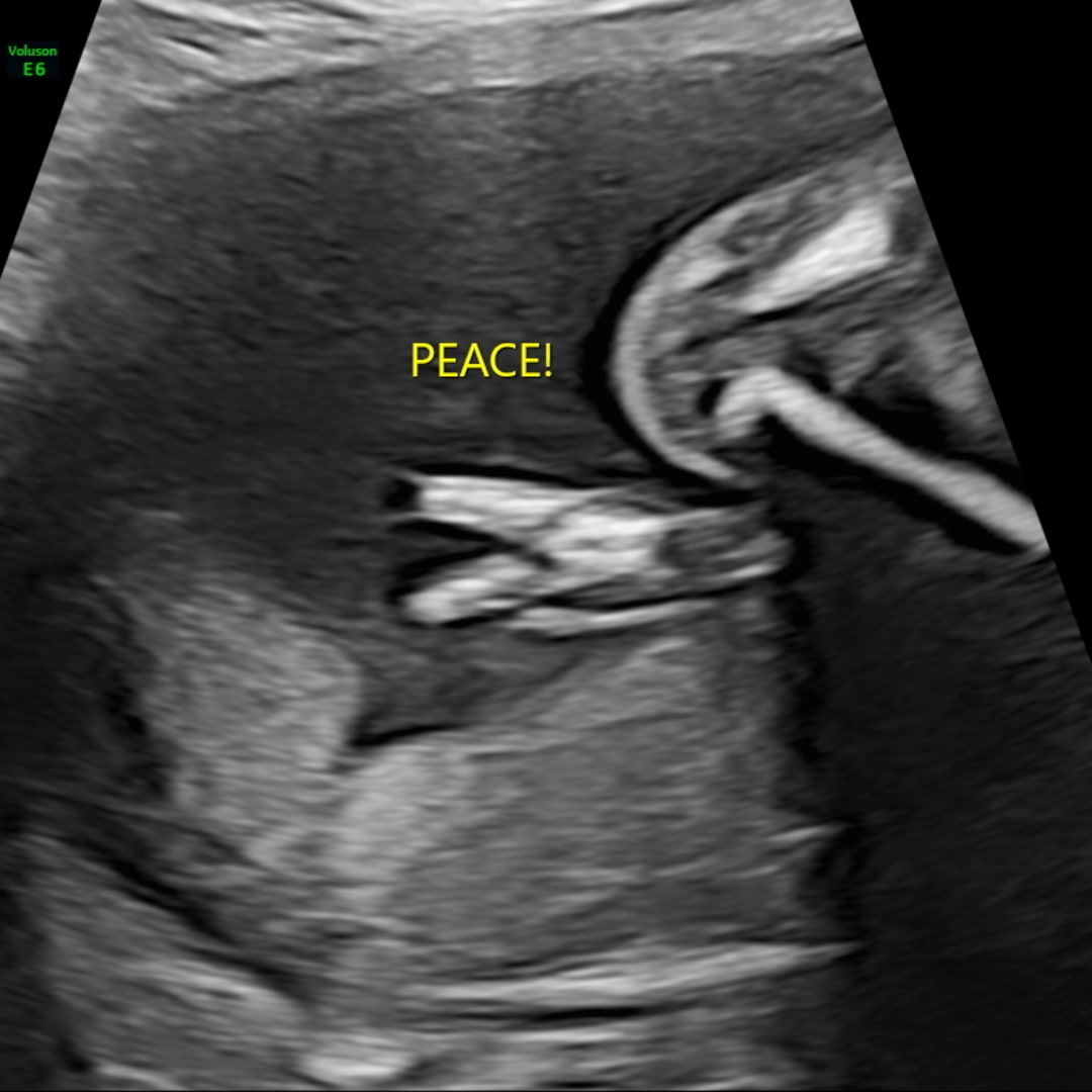 Photo shared by Isabella for their Babylist baby registry.