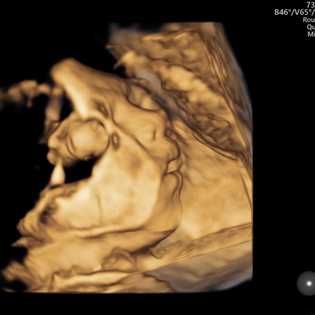 Photo shared by Iyah for their Babylist baby registry.