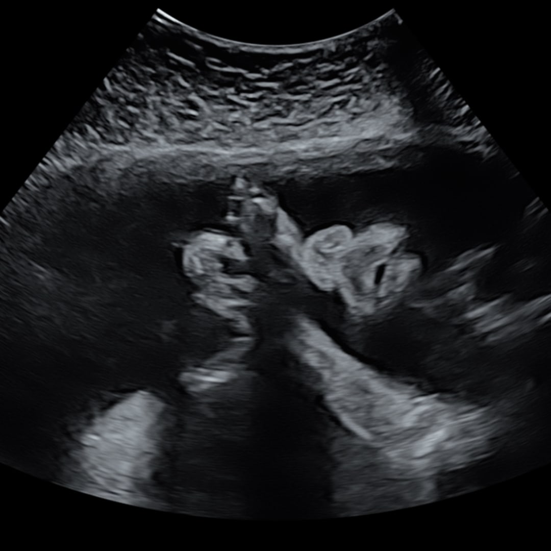 Photo shared by Alyssa for their Babylist baby registry.