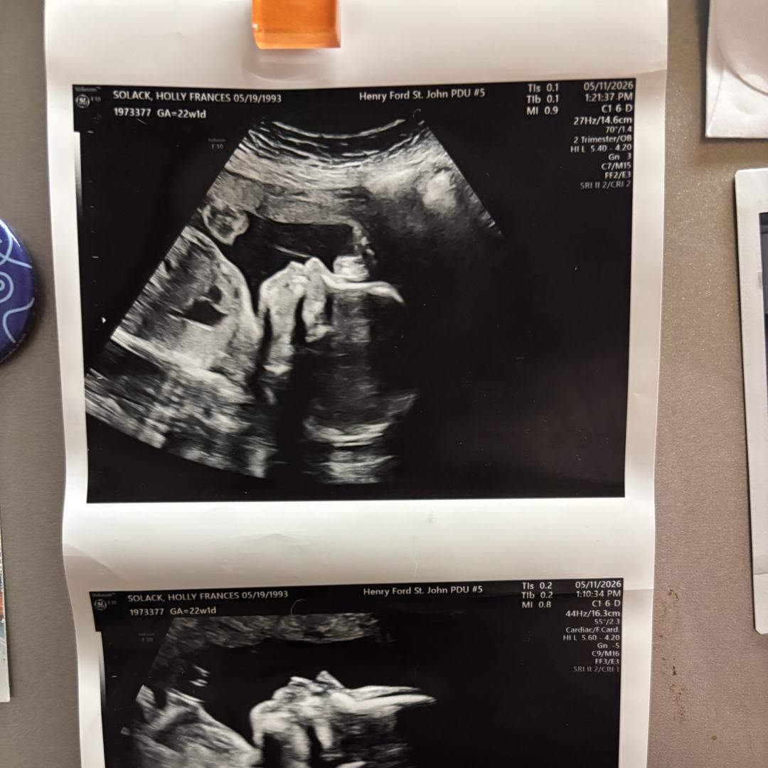 Photo shared by Holly for their Babylist baby registry.