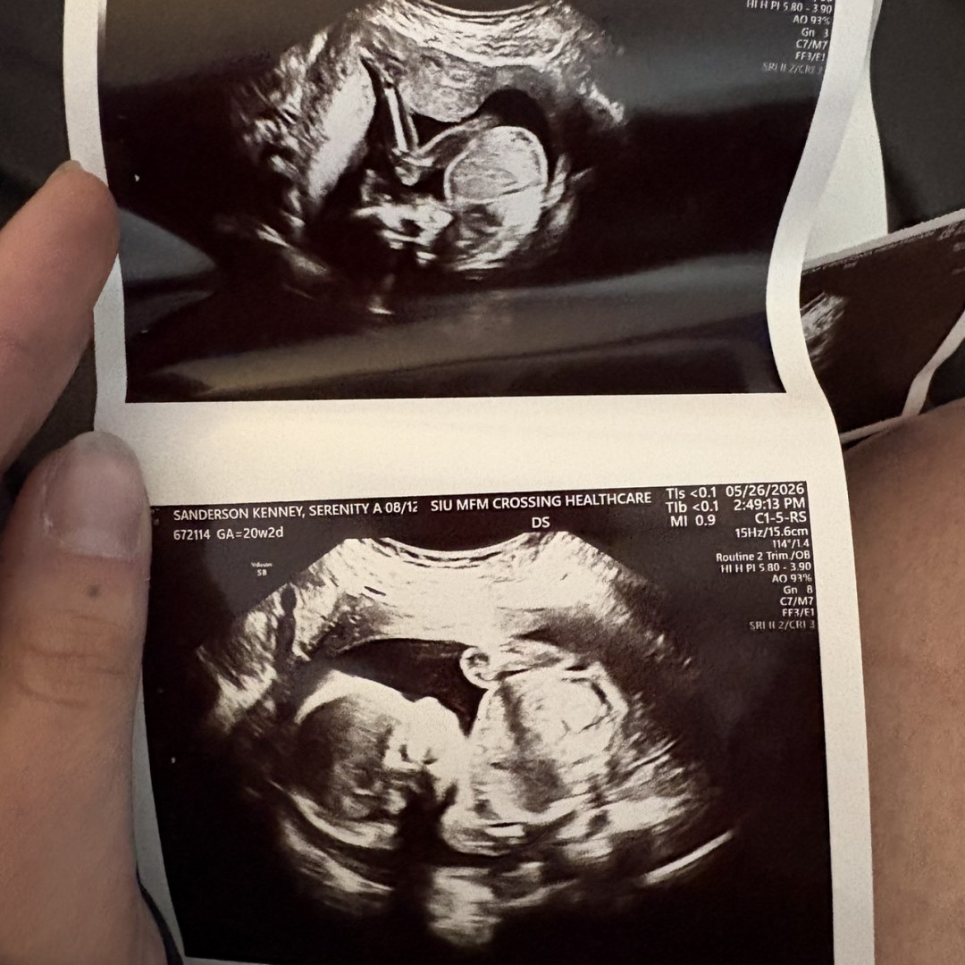Photo shared by Serenity for their Babylist baby registry.