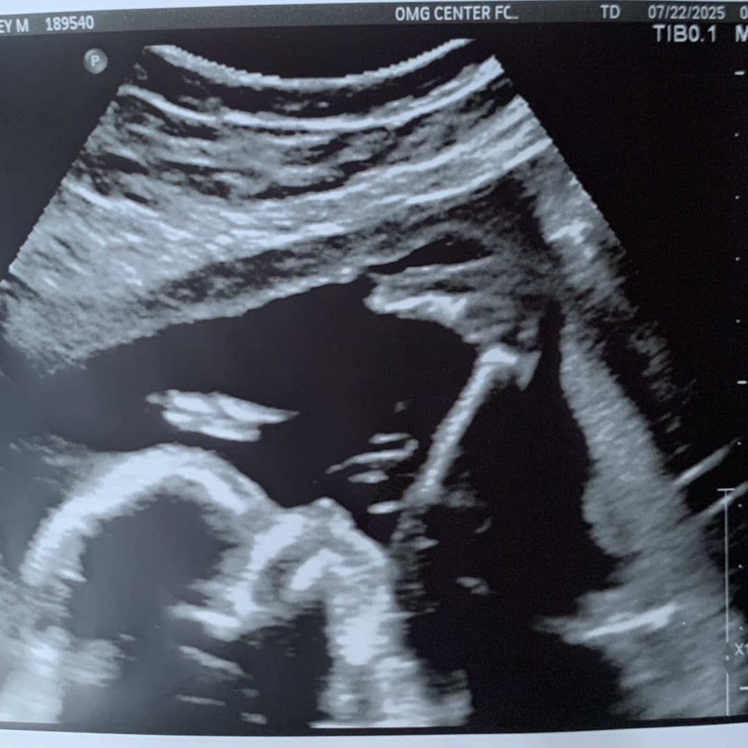 Photo shared by Bailey for their Babylist baby registry.
