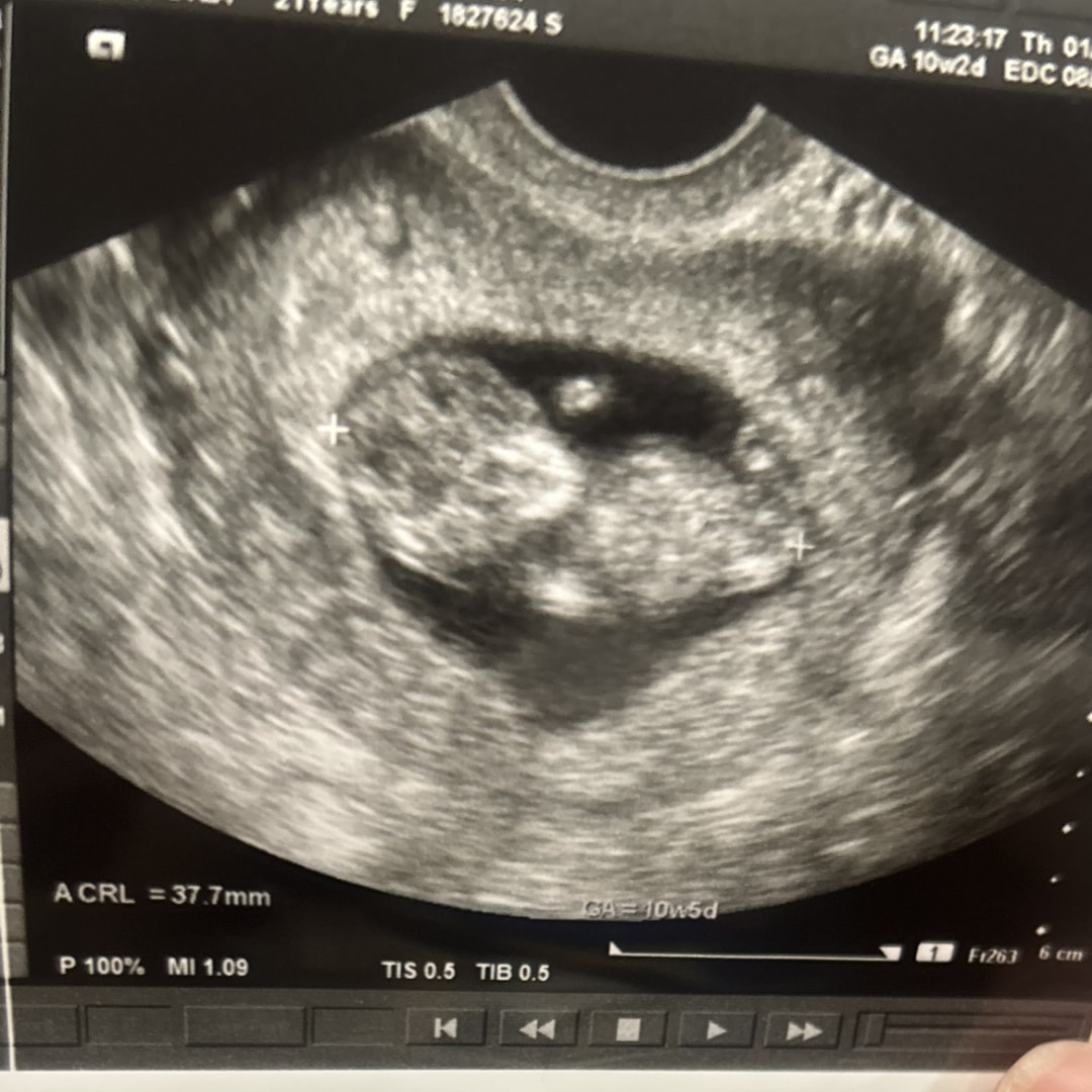 Photo shared by Alyza for their Babylist baby registry.