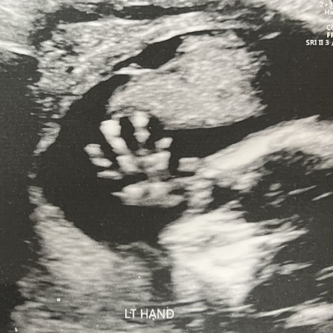 Photo shared by Israel for their Babylist baby registry.