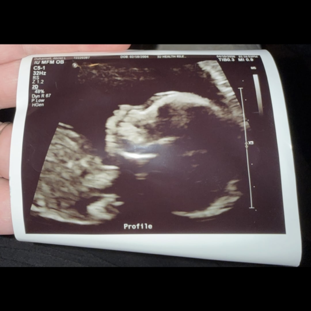 Photo shared by Abriel for their Babylist baby registry.