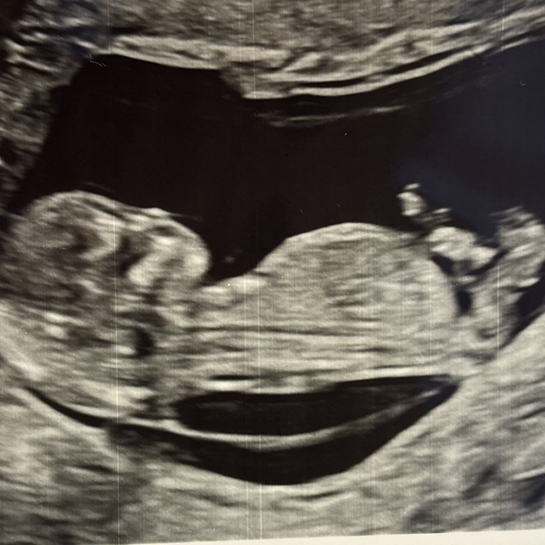 Photo shared by Karla for their Babylist baby registry.