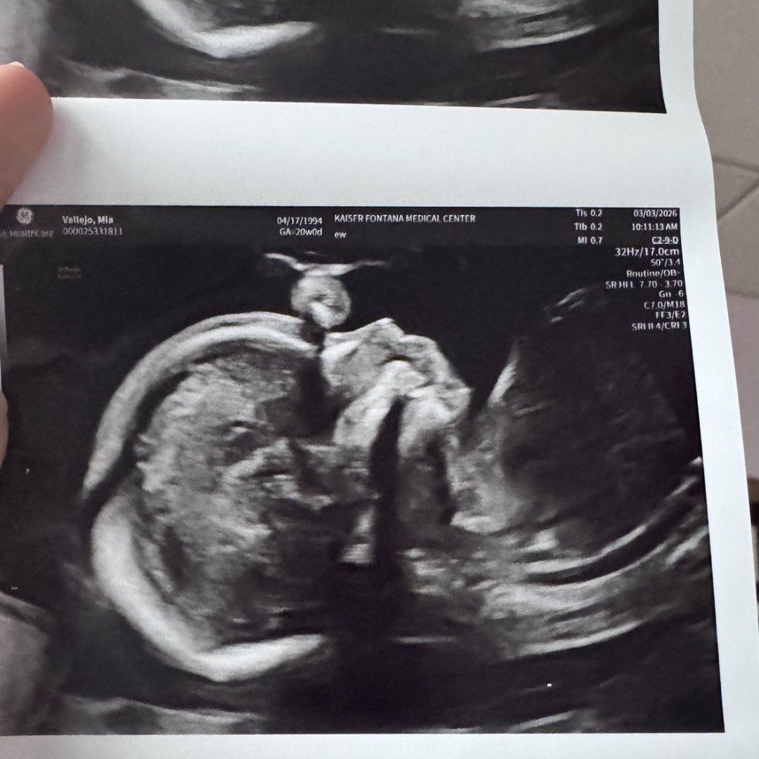 Photo shared by Mia for their Babylist baby registry.