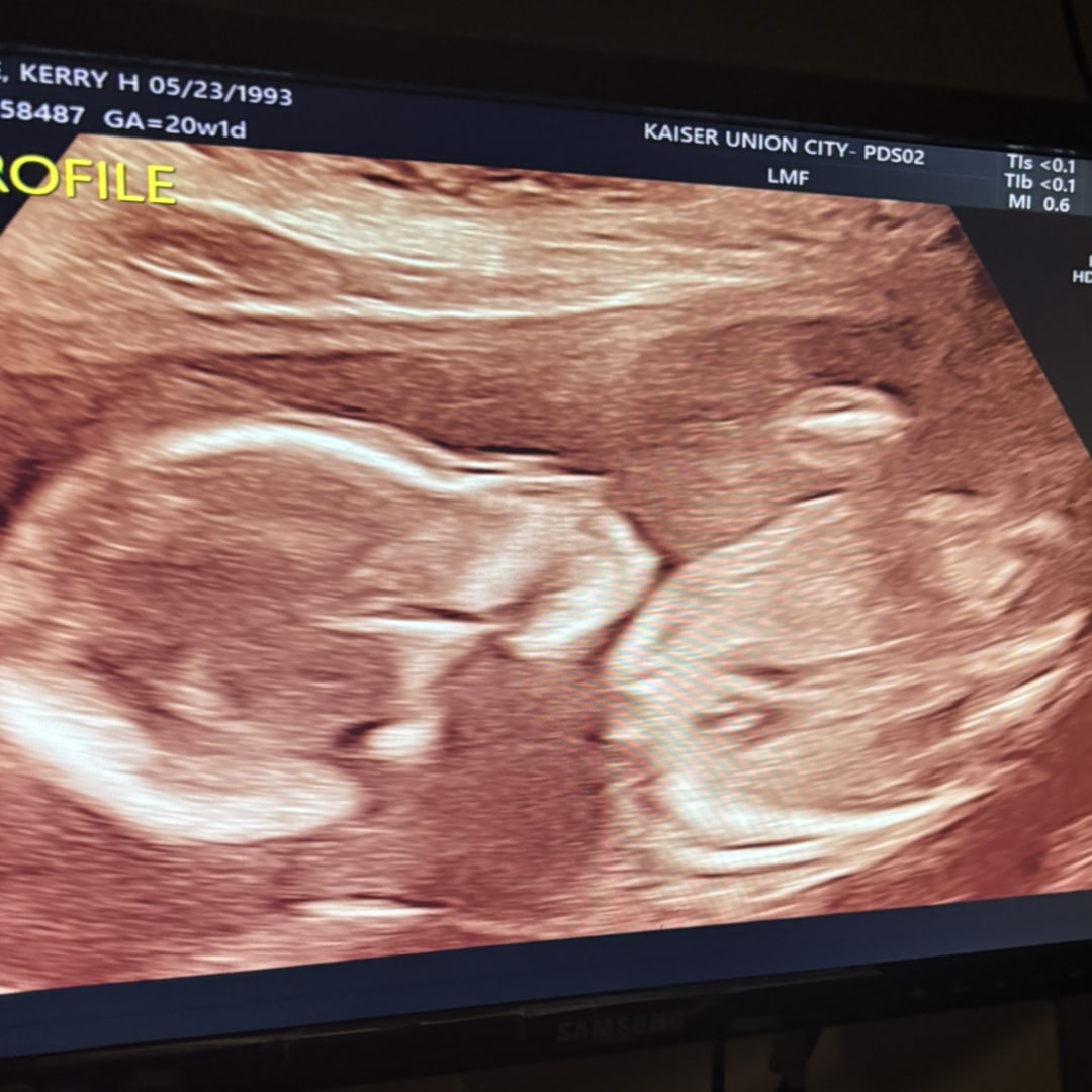 Photo shared by Kerry for their Babylist baby registry.