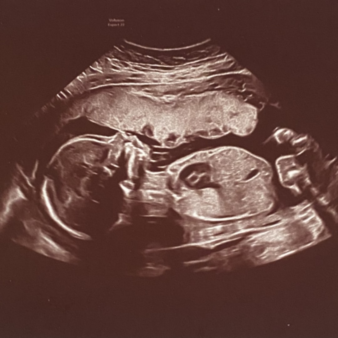 Photo shared by Natalie for their Babylist baby registry.