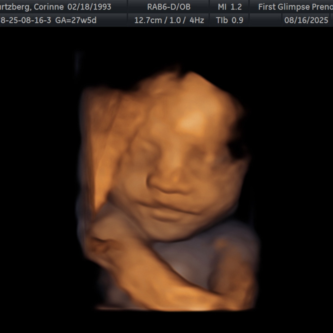 Photo shared by Corinne for their Babylist baby registry.