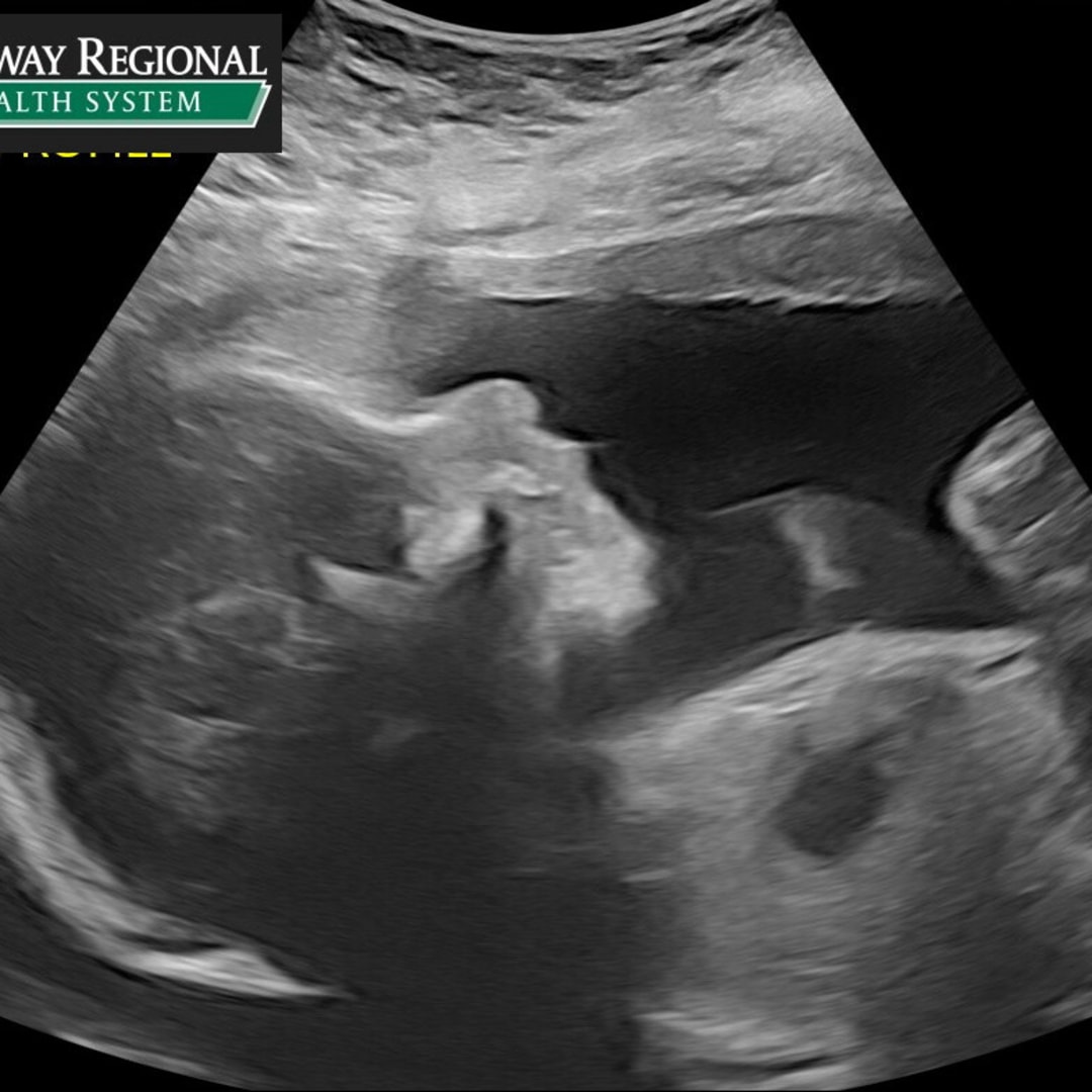 Photo shared by Rylie for their Babylist baby registry.