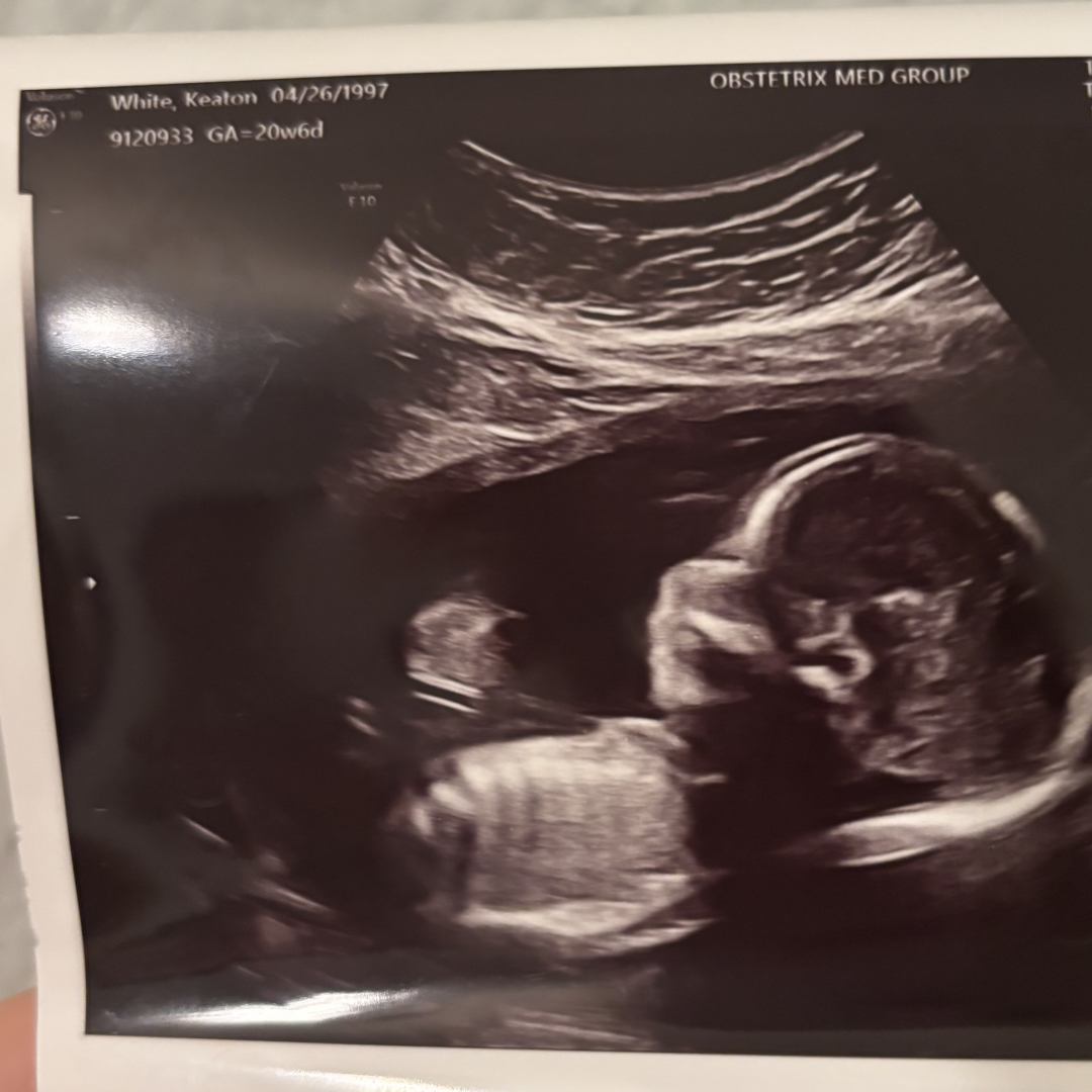 Photo shared by Keaton for their Babylist baby registry.