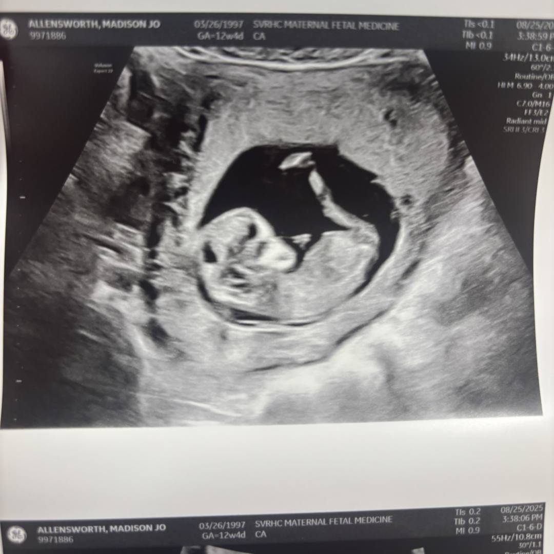 Photo shared by Maddie for their Babylist baby registry.