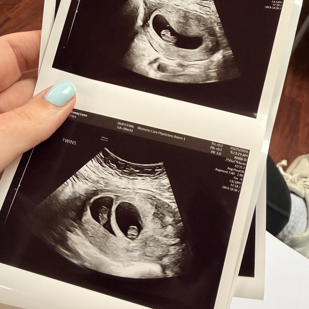 Photo shared by Casey for their Babylist baby registry.