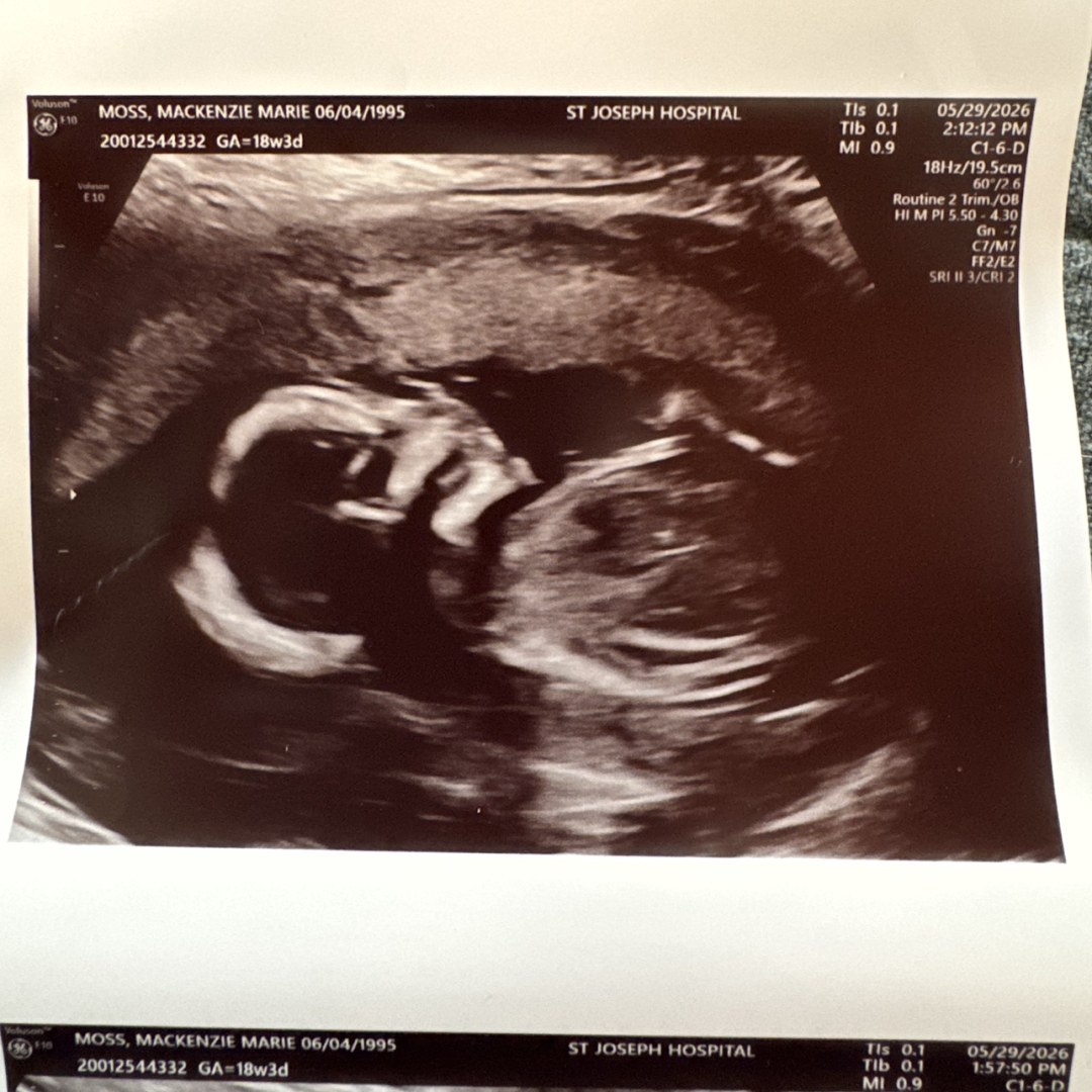 Photo shared by MacKenzie for their Babylist baby registry.