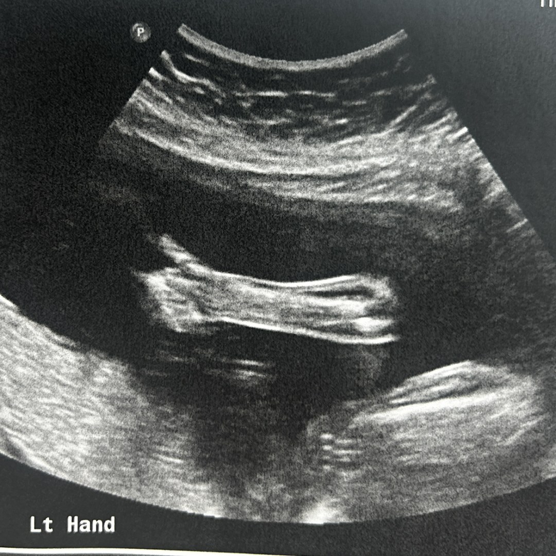Photo shared by Daritza for their Babylist baby registry.