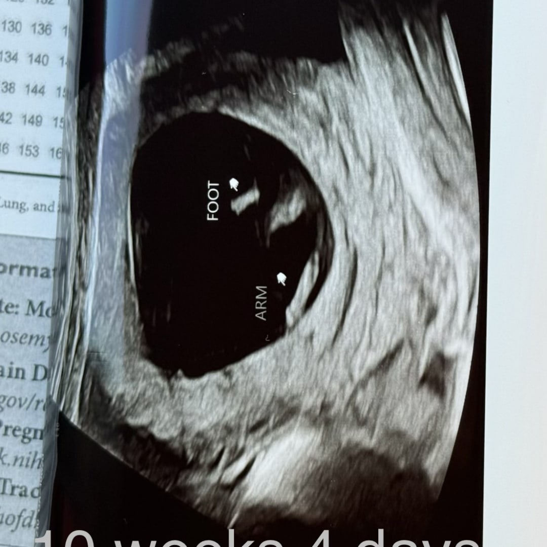 Photo shared by Ianna for their Babylist baby registry.