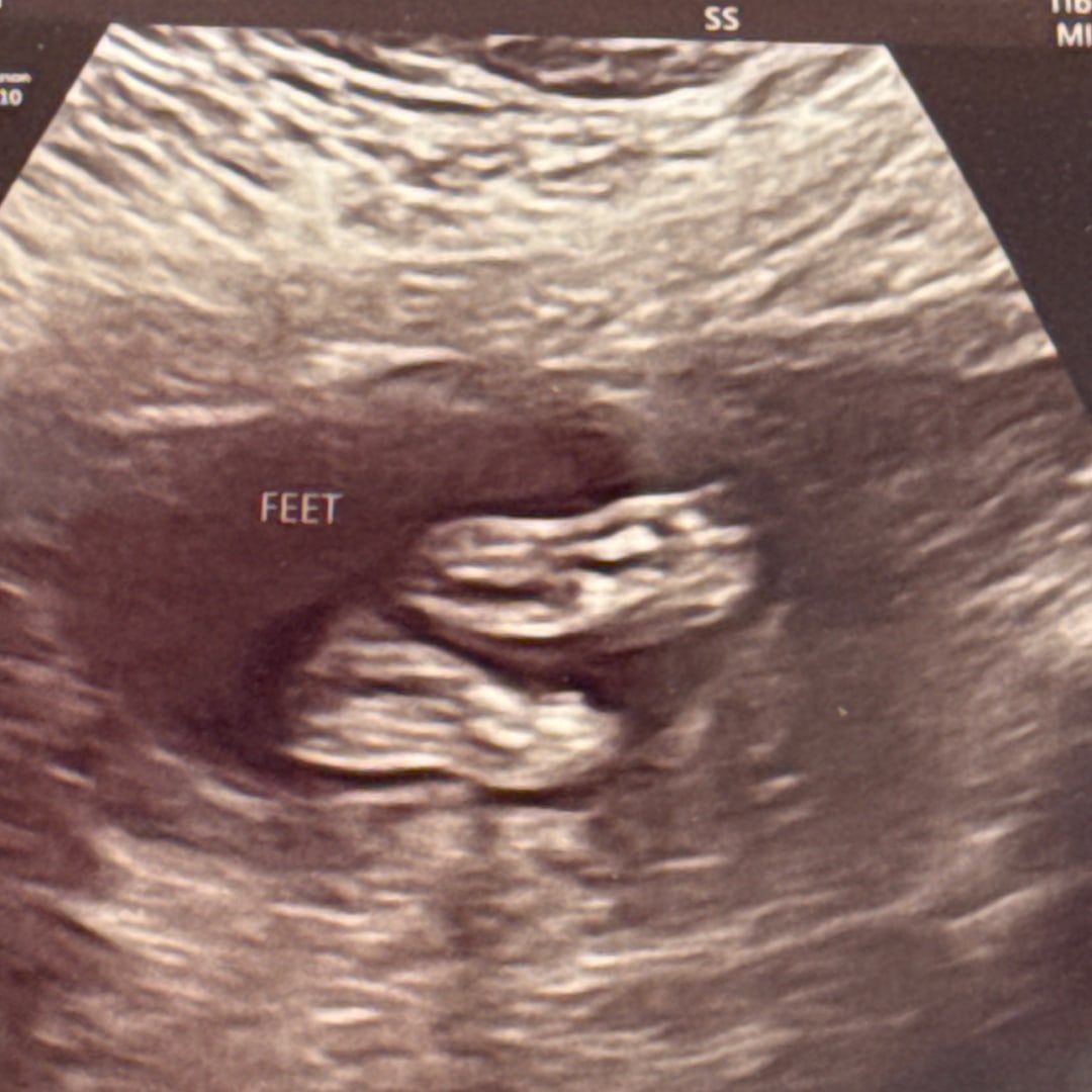 Photo shared by Angel for their Babylist baby registry.