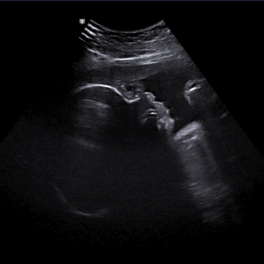 Photo shared by Cameron for their Babylist baby registry.