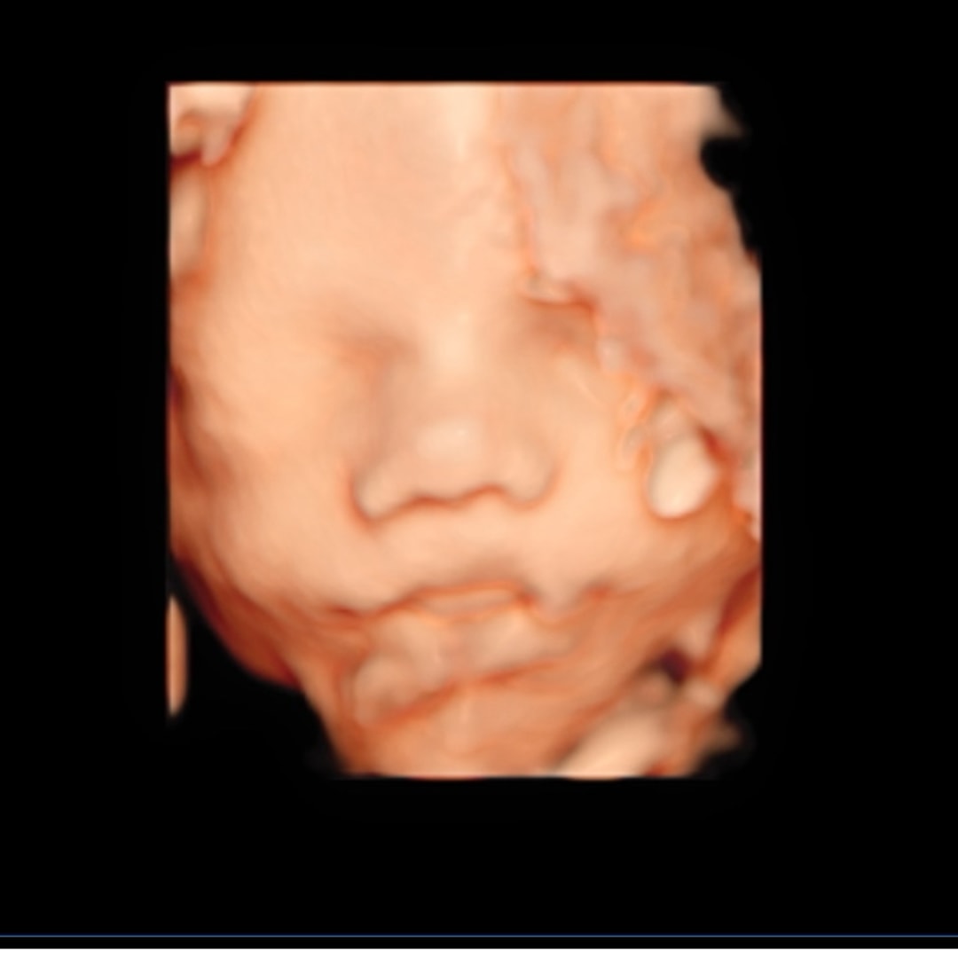 Photo shared by Hannah for their Babylist baby registry.
