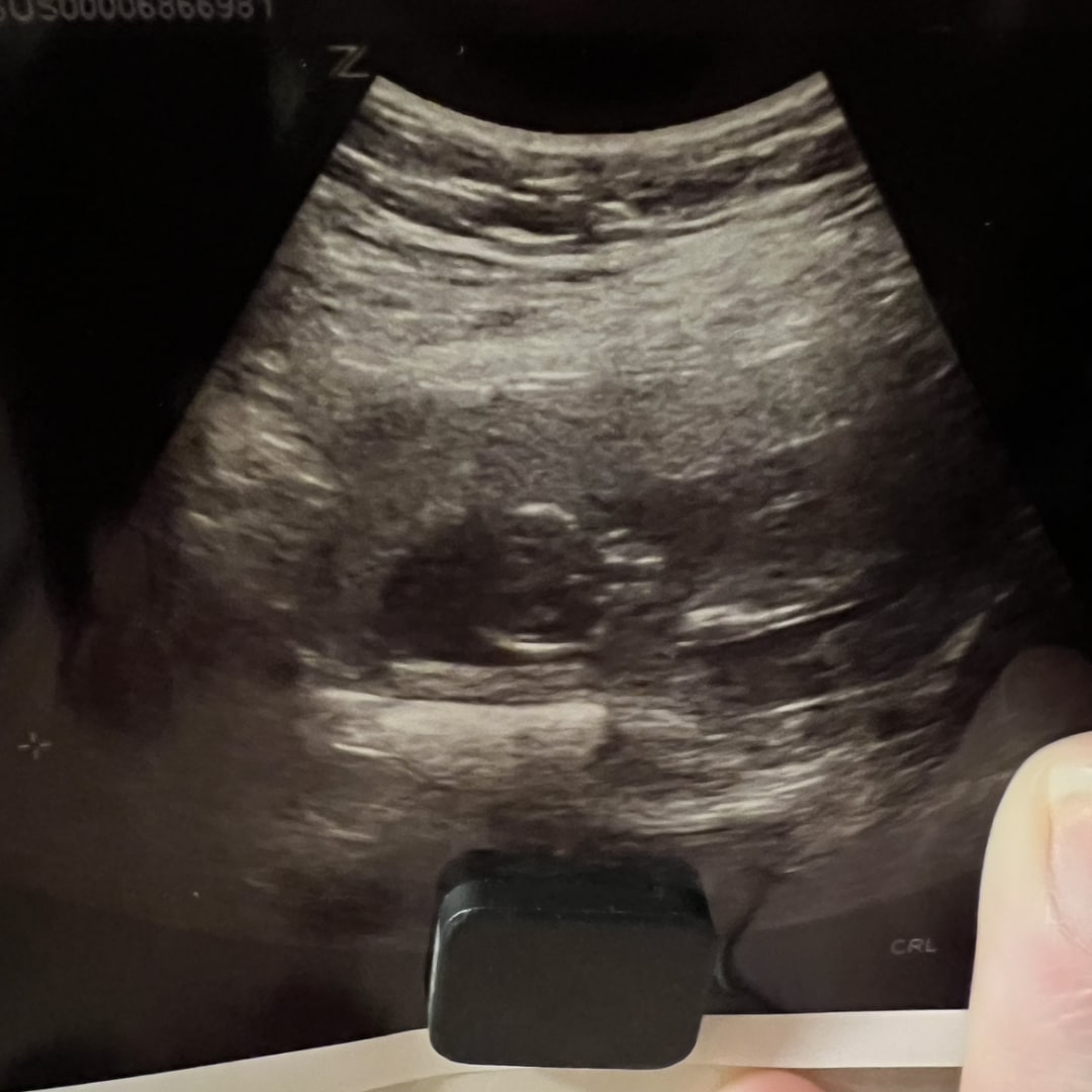 Photo shared by Amanda for their Babylist baby registry.