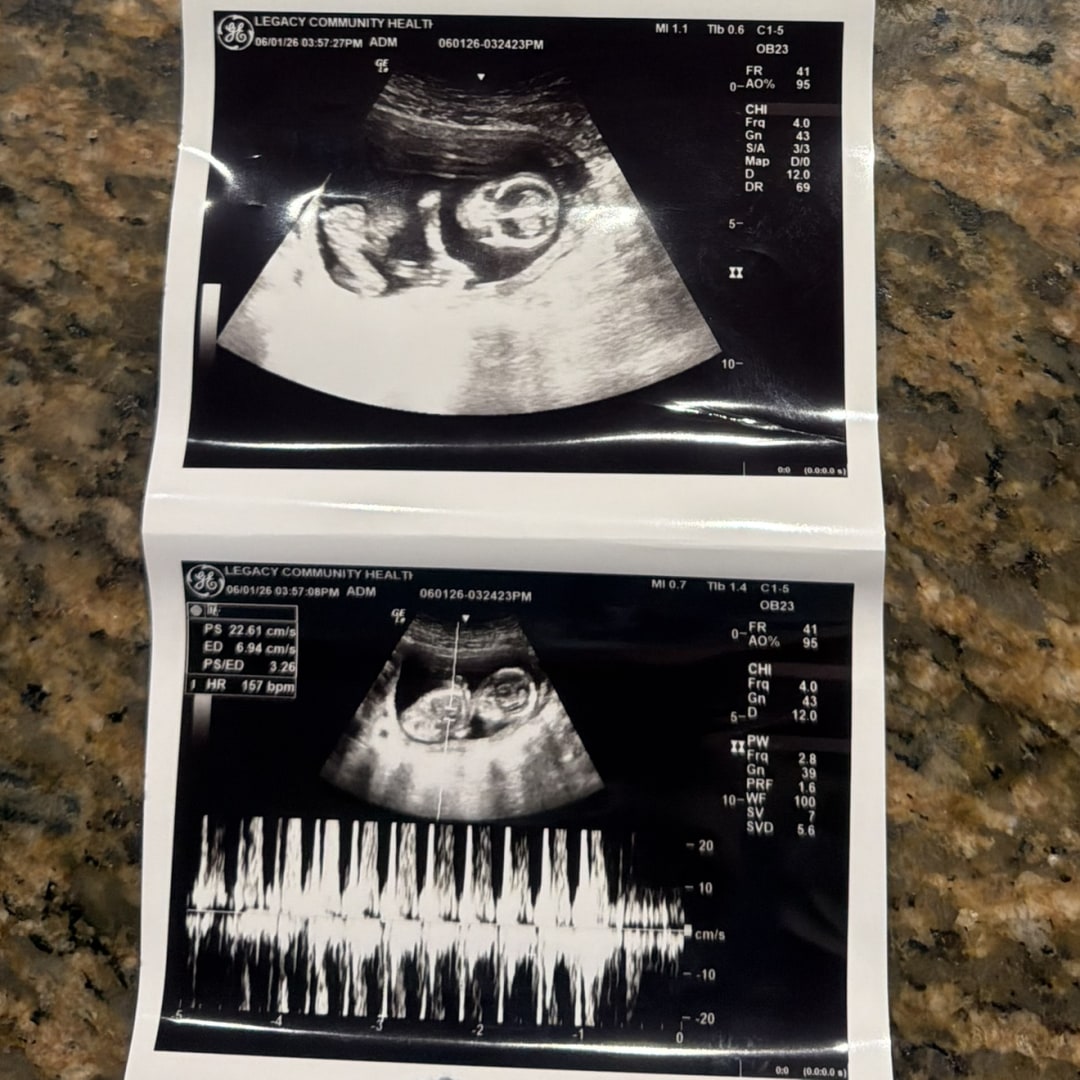 Photo shared by Nevaeh for their Babylist baby registry.