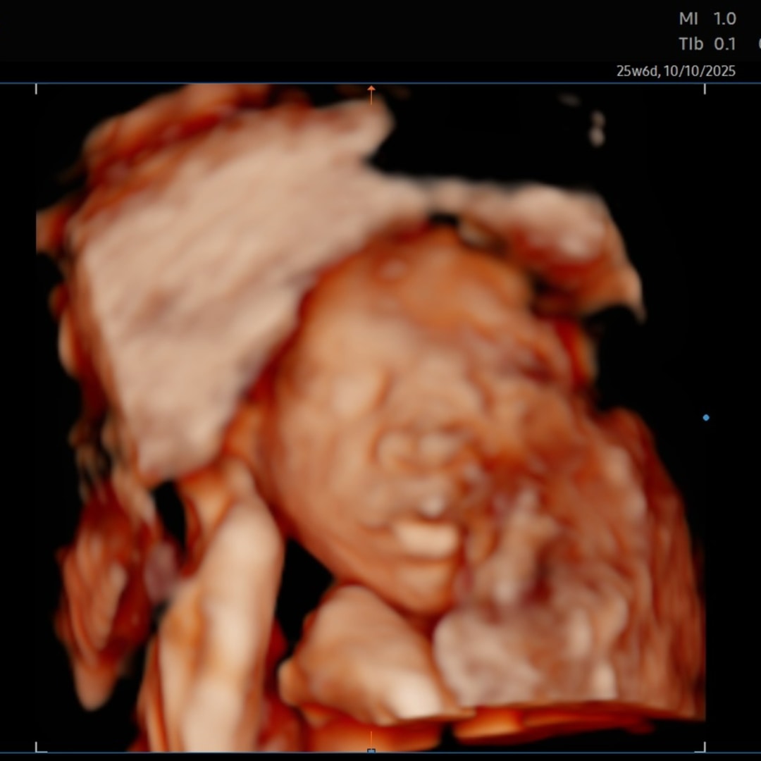 Photo shared by Ashtin for their Babylist baby registry.