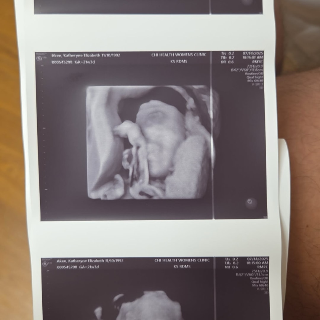 Photo shared by Kaytie for their Babylist baby registry.