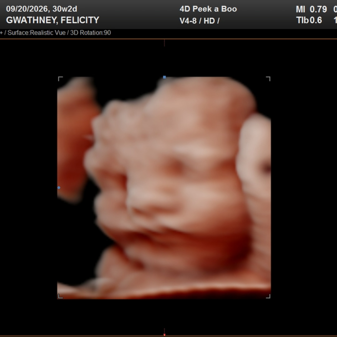 Photo shared by Felicity for their Babylist baby registry.