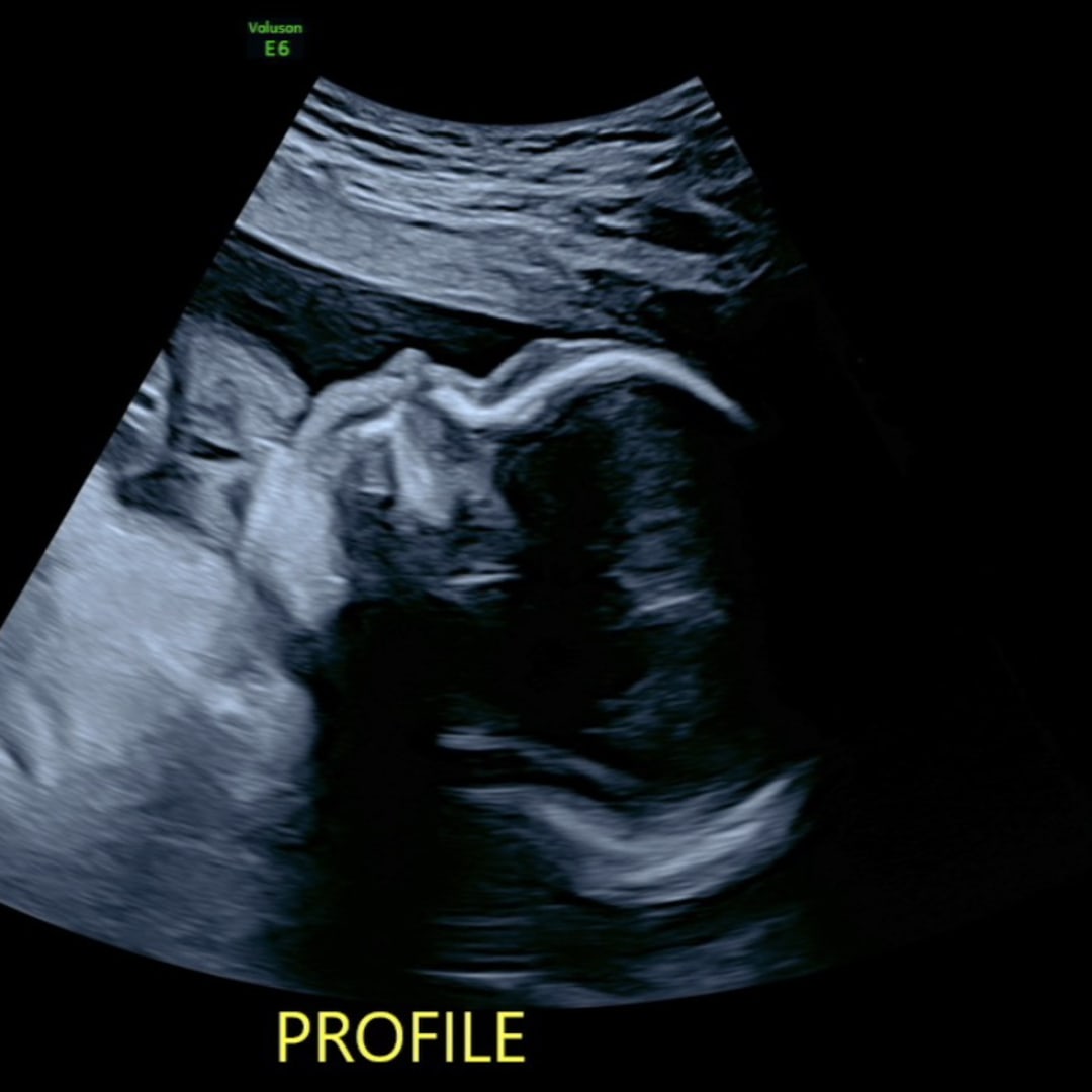 Photo shared by Danyelin for their Babylist baby registry.