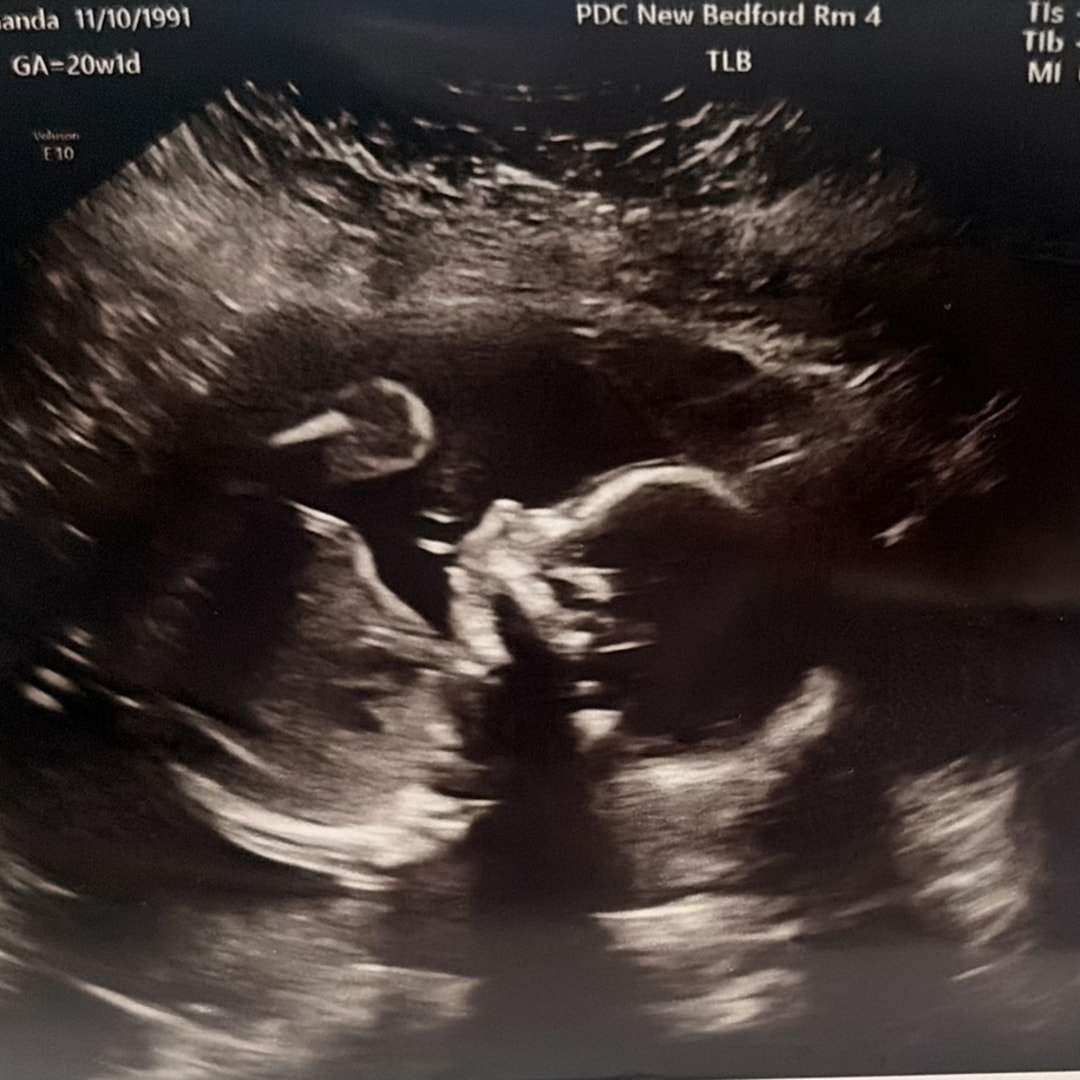 Photo shared by Amanda for their Babylist baby registry.