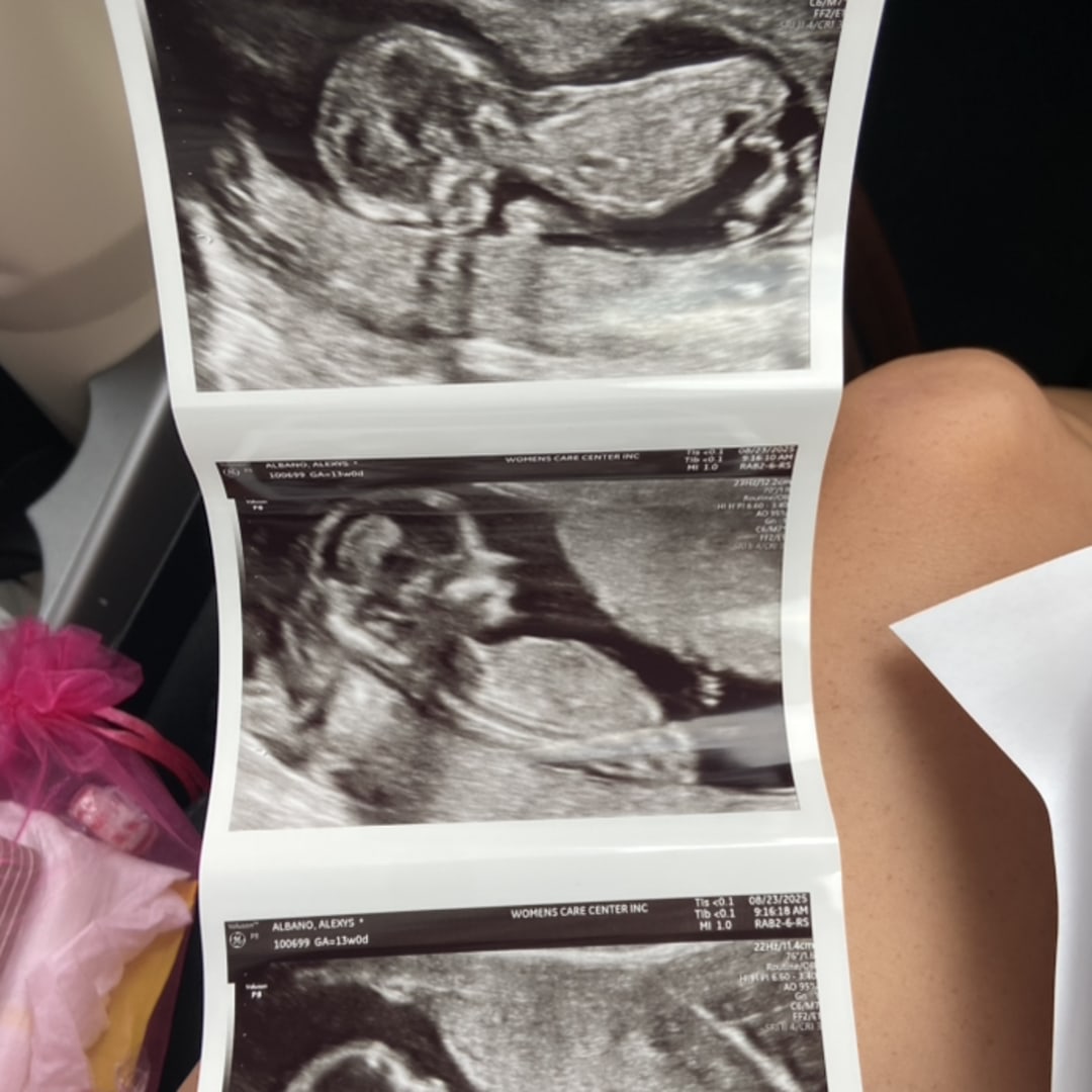 Photo shared by Lexy for their Babylist baby registry.