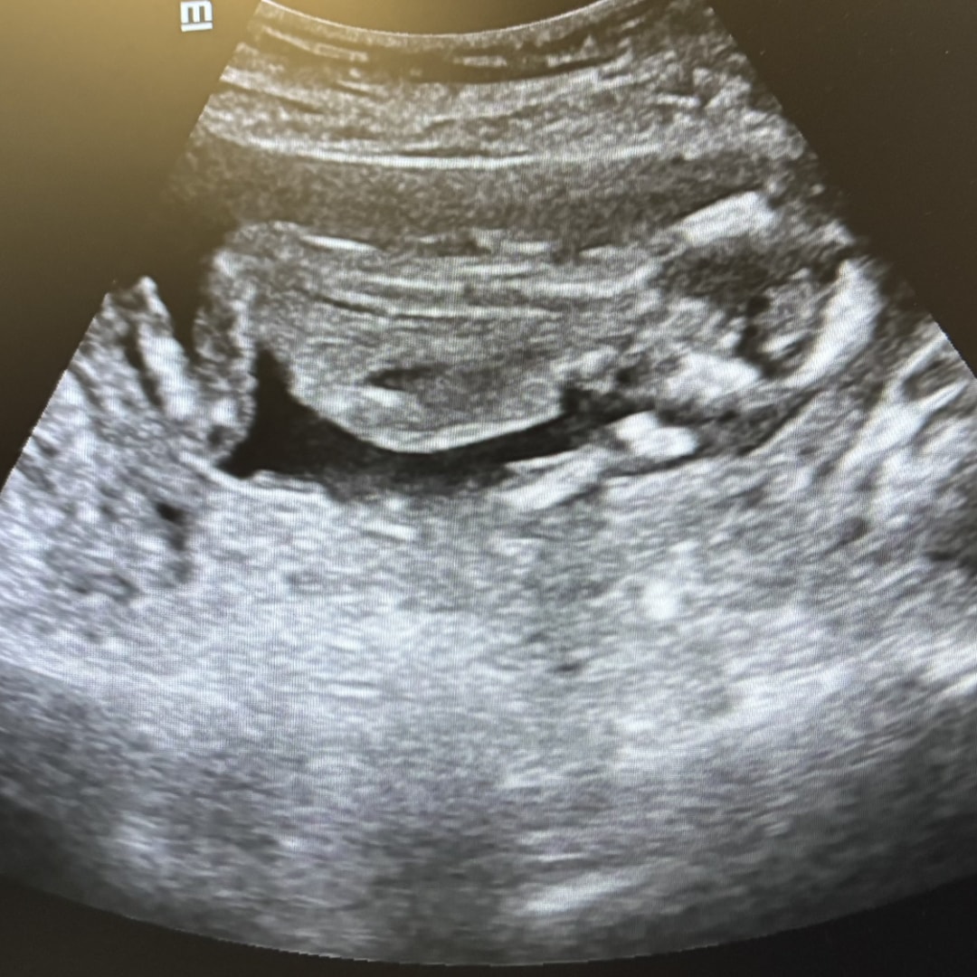 Photo shared by Erica for their Babylist baby registry.