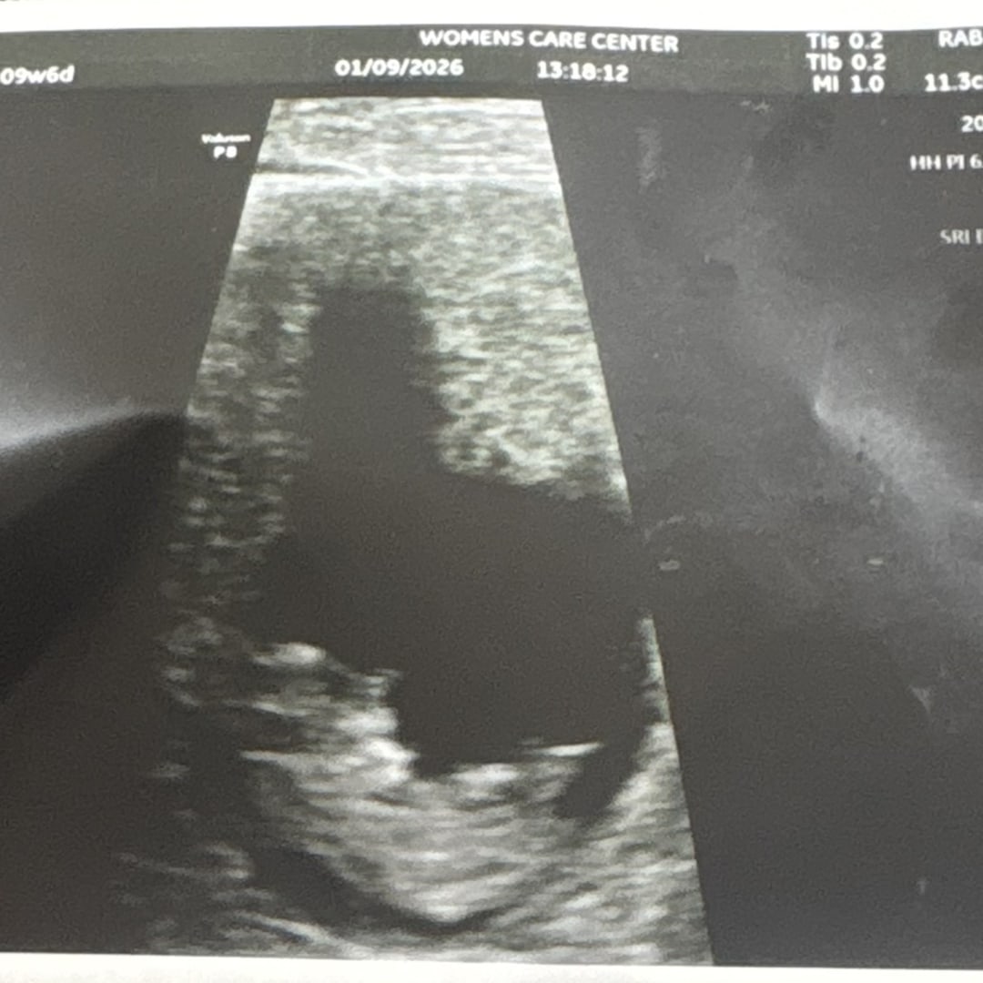 Photo shared by Beyonce for their Babylist baby registry.