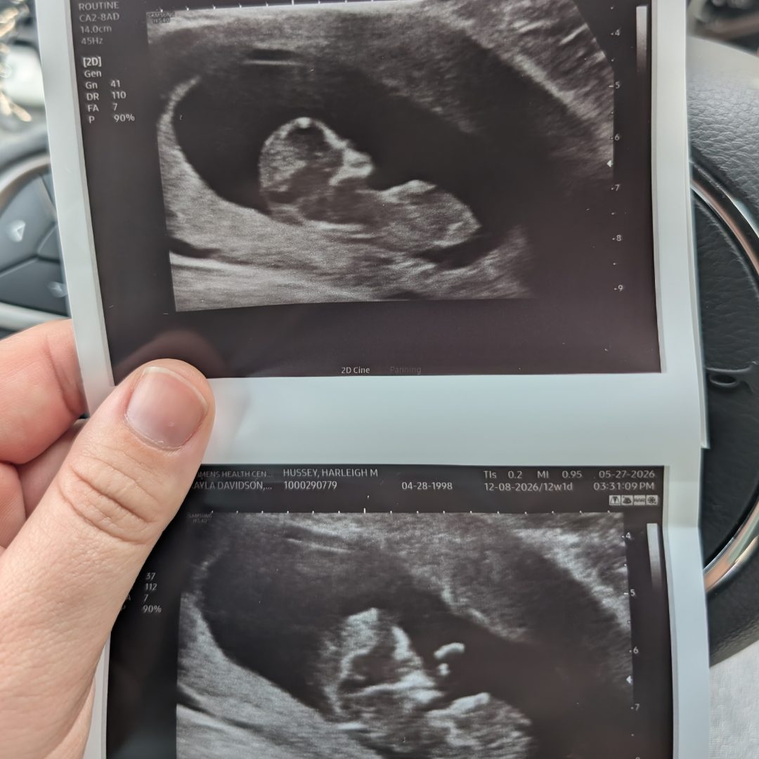Photo shared by Harleigh for their Babylist baby registry.