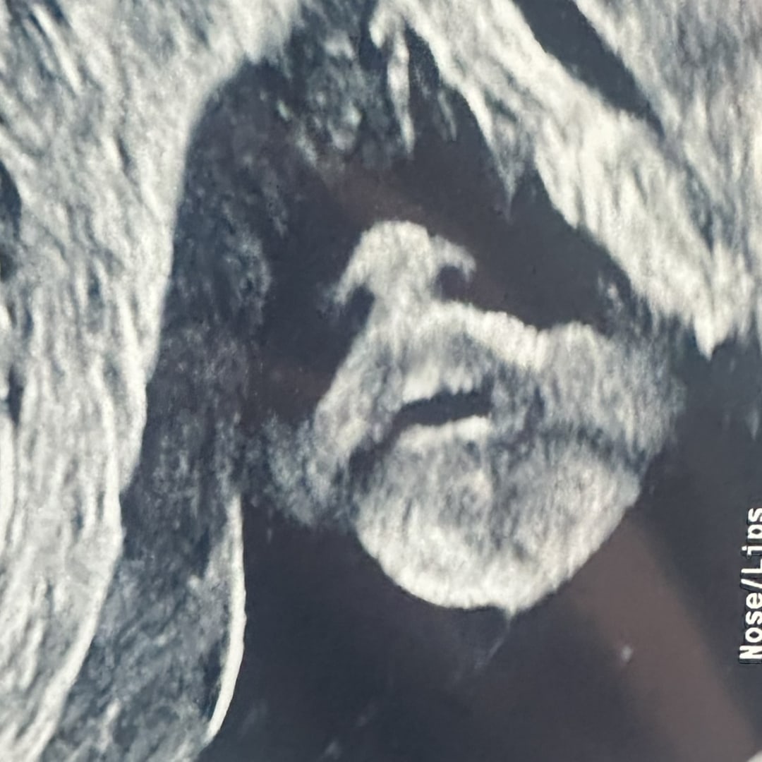 Photo shared by Brittany for their Babylist baby registry.