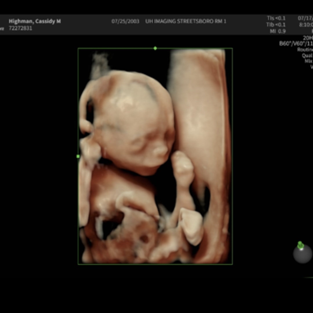 Photo shared by Cassidy for their Babylist baby registry.
