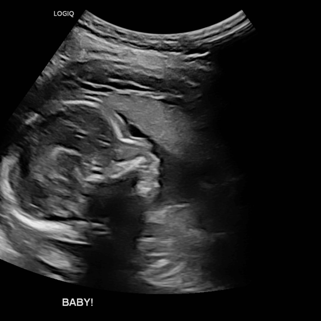 Photo shared by Cyenna for their Babylist baby registry.
