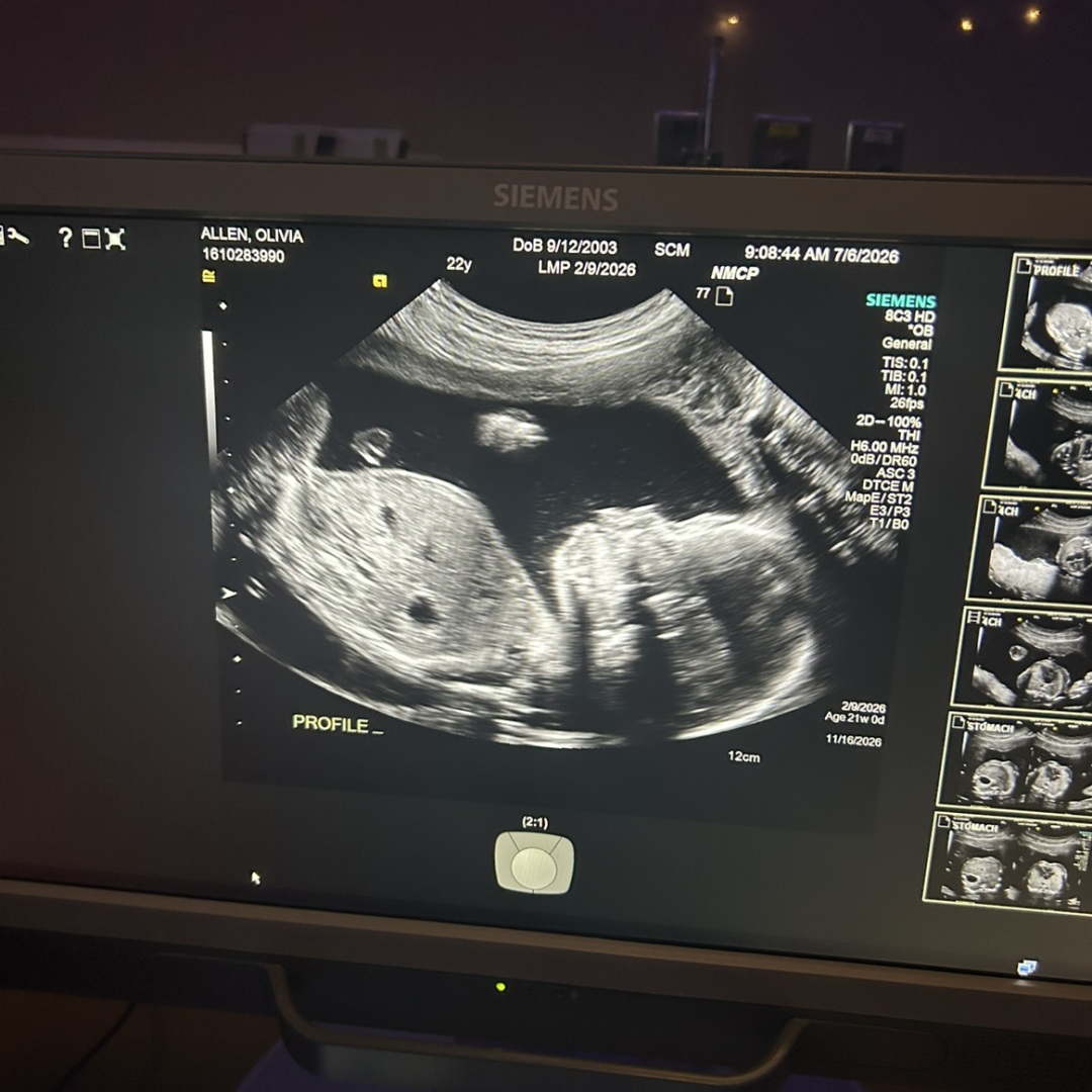 Photo shared by Olivia for their Babylist baby registry.