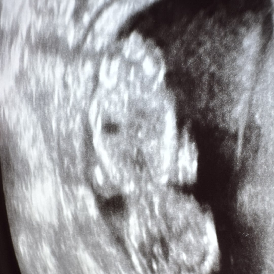 Photo shared by Emily for their Babylist baby registry.