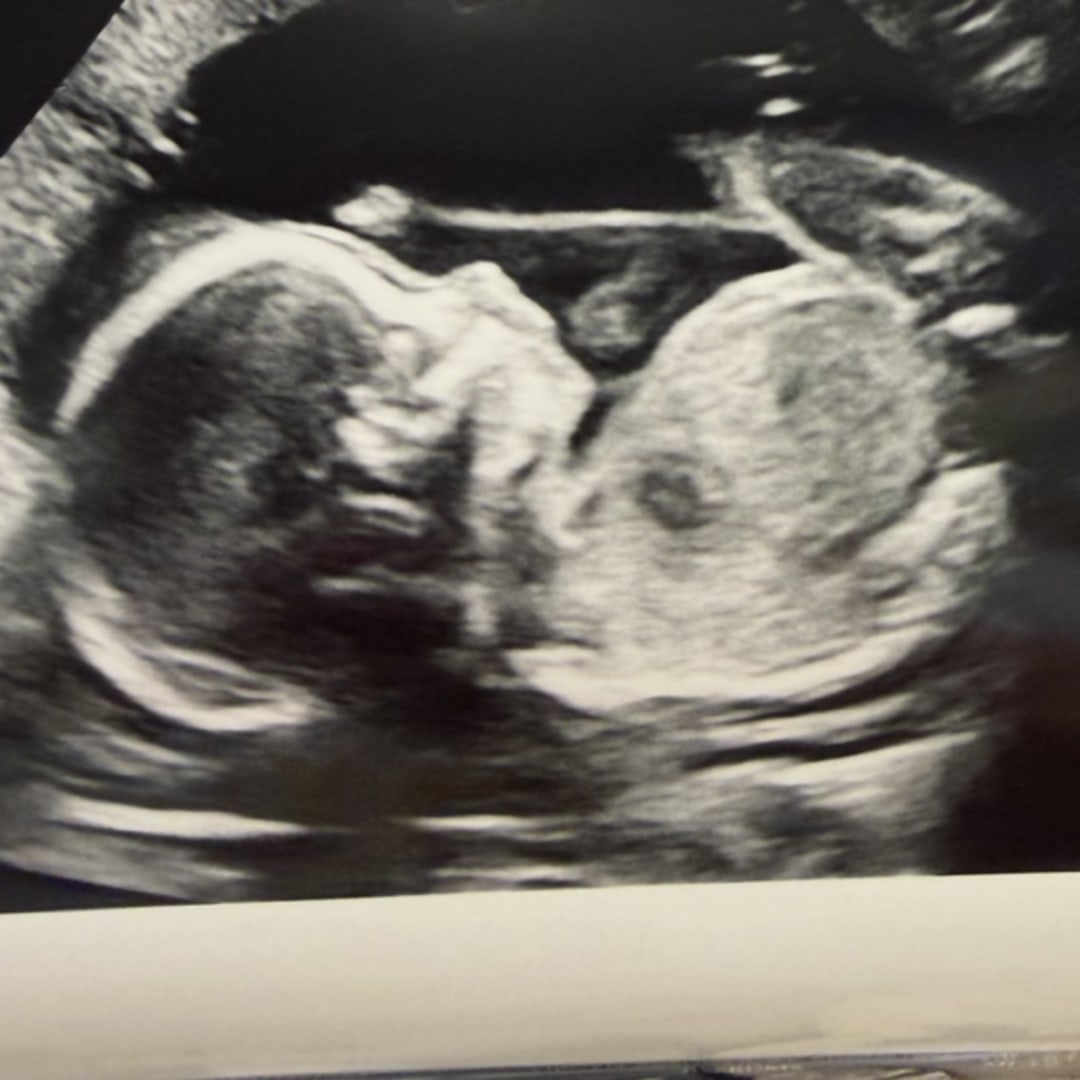 Photo shared by Hannah for their Babylist baby registry.