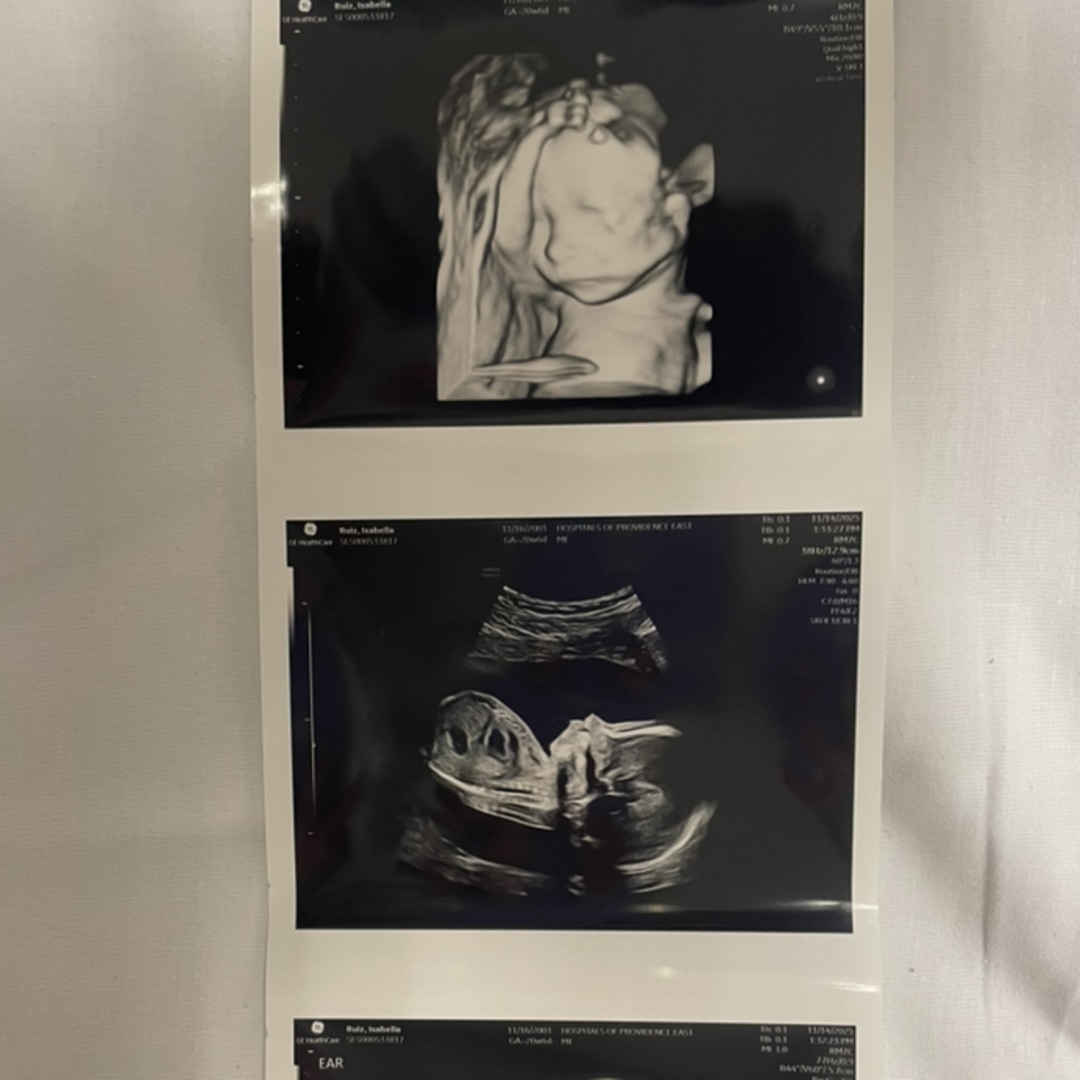 Photo shared by Isabella for their Babylist baby registry.