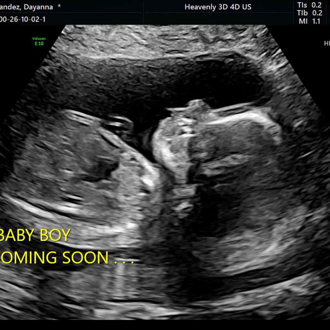 Photo shared by Dayanna for their Babylist baby registry.