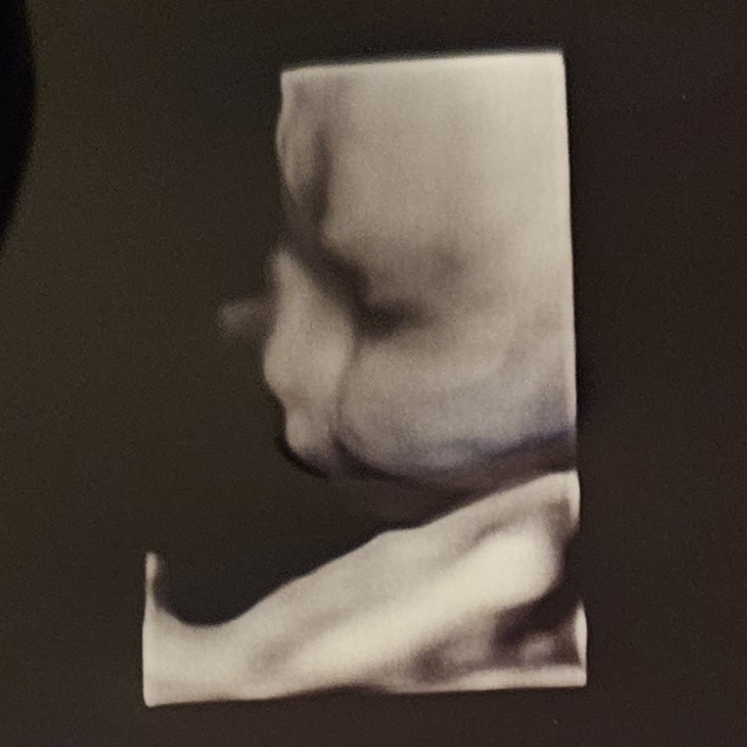 Photo shared by Carina for their Babylist baby registry.