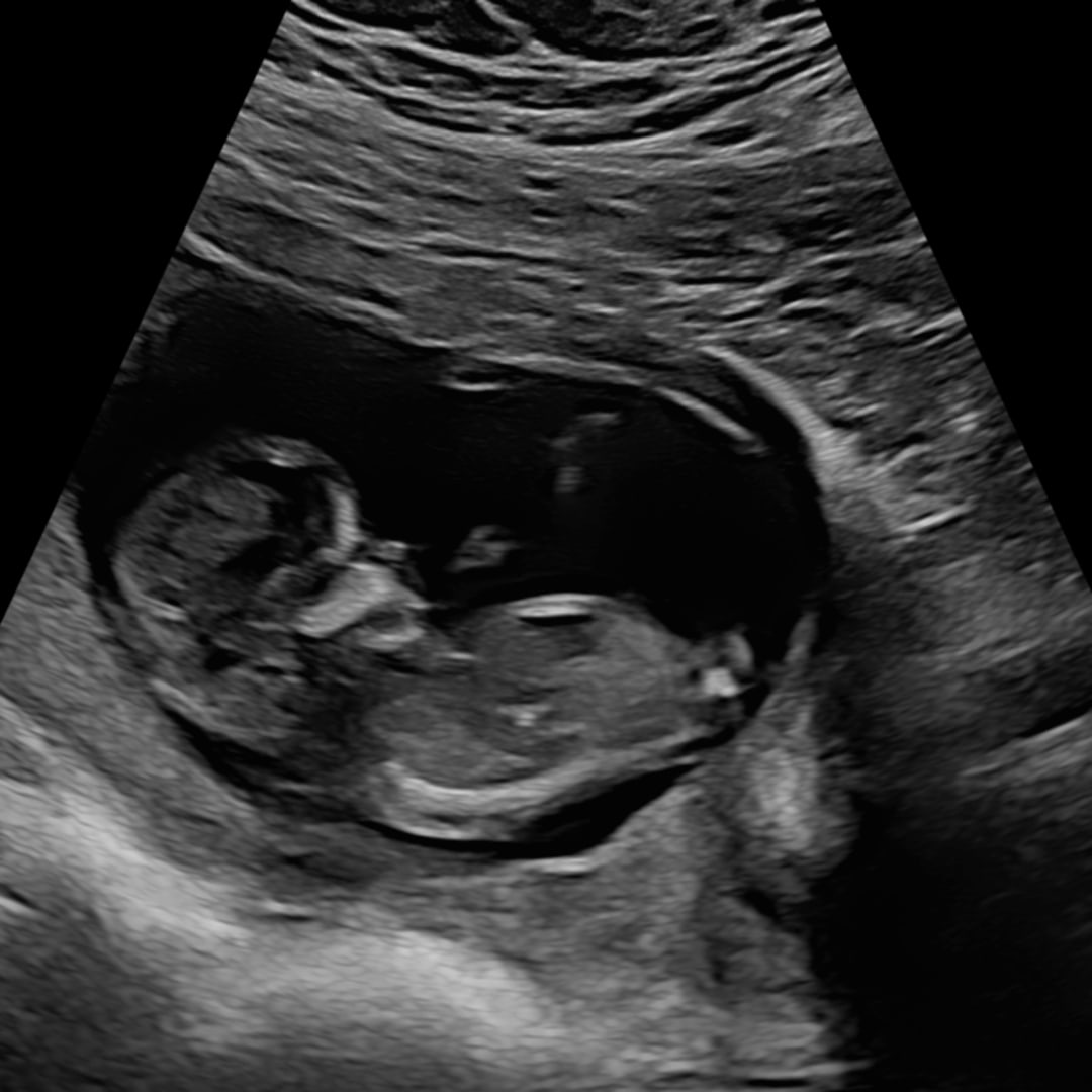 Photo shared by Abby for their Babylist baby registry.