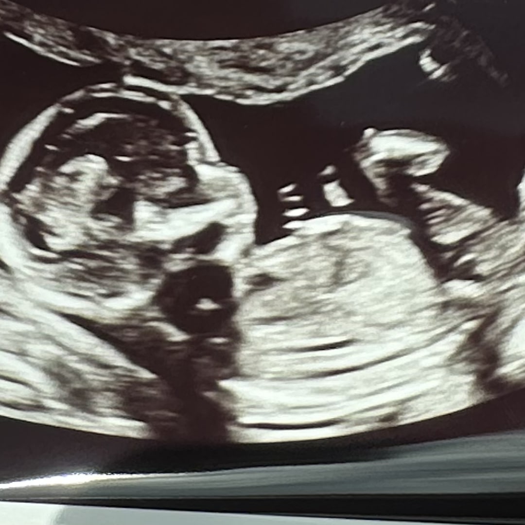 Photo shared by Amanda for their Babylist baby registry.